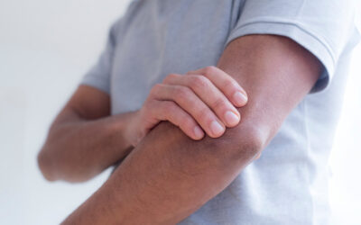 Pickleball Elbow – Symptoms, Causes and How to Treat It